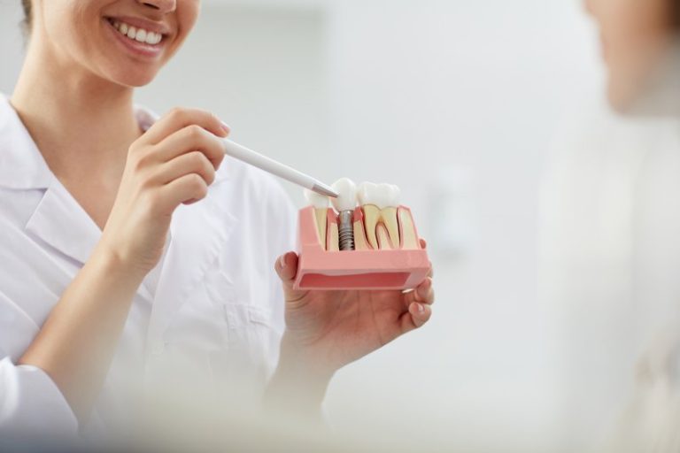 Elevating Self-Esteem: The Social Impact of Dental Implants
